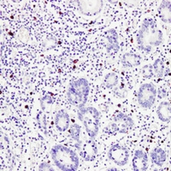 TPSAB1 Antibody