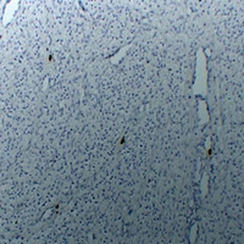 TPSAB1 Antibody