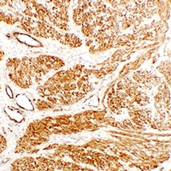 Caldesmon Antibody