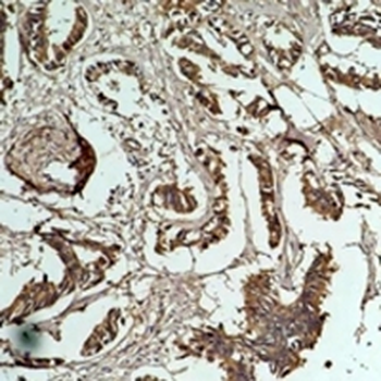 HSP27 Antibody