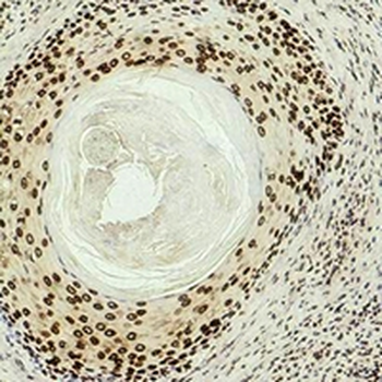 Histone H3 (DiMethyl K27) Antibody