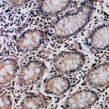 Collagen 17 alpha 1 Antibody