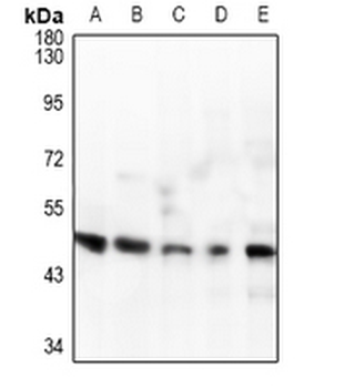 IL-1R2 Antibody