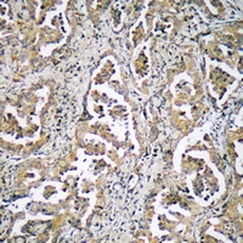 ADAMTS17 Antibody