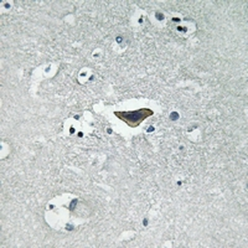 CDC25 (pS916) Antibody