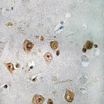 NCOA3 Antibody