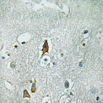 CD125 Antibody