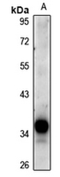 DCR3 Antibody