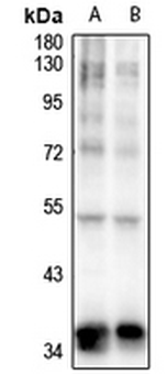 TOB (pS164) Antibody