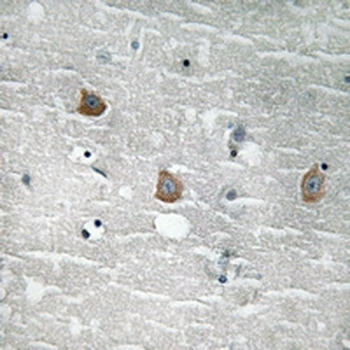 TOB (pS164) Antibody