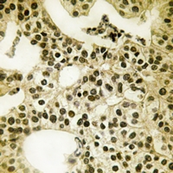 PALF (pS116) Antibody