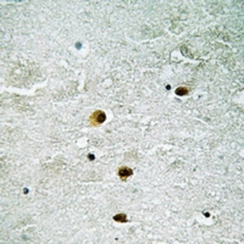 HSP27 (pS78) Antibody