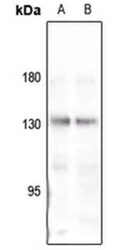 Collagen 4 alpha 3 Antibody