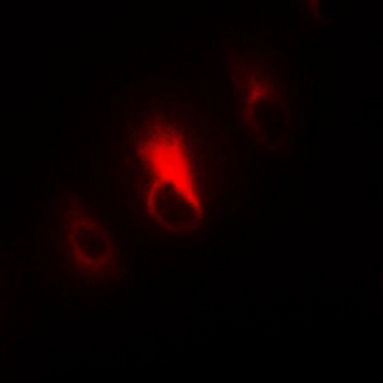 Collagen 4 alpha 3 Antibody