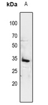14-3-3 sigma Antibody