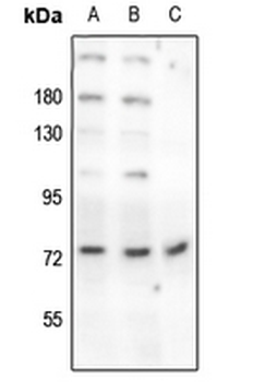 Beta-NaCH (pT615) Antibody