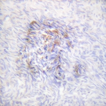 Aconitase 1 (pS138) Antibody