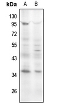 Cyclin D1 (pS90) Antibody