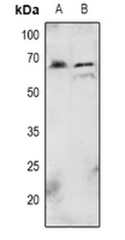 AKT (pT72) Antibody