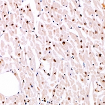 MITF (pS180) Antibody