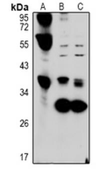 Hepassocin Antibody