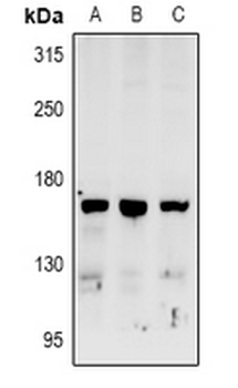 RAB3GAP2 Antibody