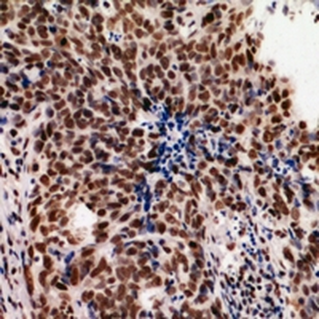 hnRNP UL2 Antibody