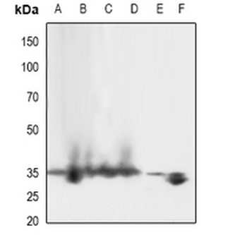 LAT (pY161) Antibody