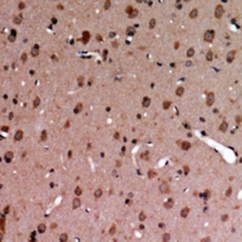 MERTK/TYRO3 (pY749/681) Antibody