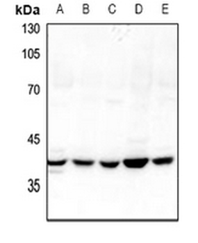 GDI2 Antibody