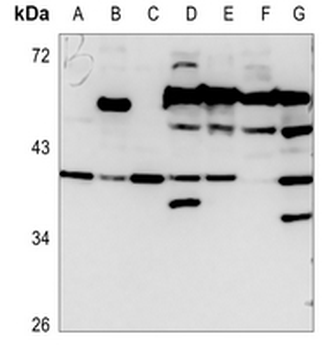 CD129 Antibody