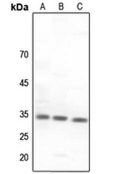 CNOT7 Antibody