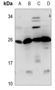 CIDEB Antibody