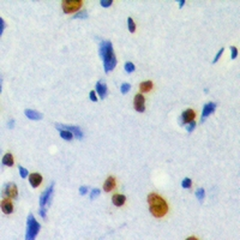 MKI67IP (pT234) Antibody