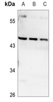 VPS4B Antibody