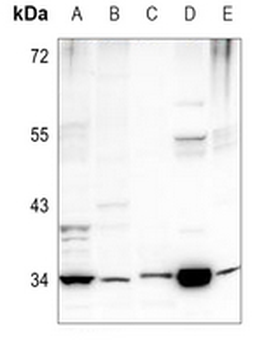 PEX2 Antibody