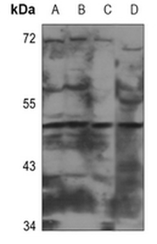 CADM2 Antibody
