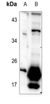 TUSC5 Antibody