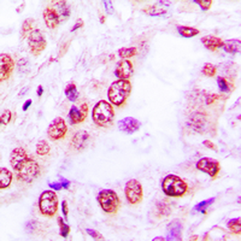 SKIL Antibody
