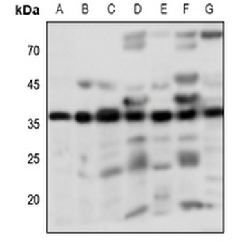 PGD2 Receptor Antibody