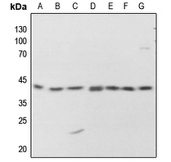 PKA C alpha/beta/gamma (pT198) Antibody