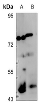 c-Jun (pS73/100) Antibody