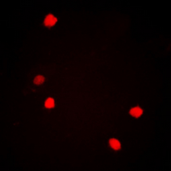 c-Jun (pS73/100) Antibody