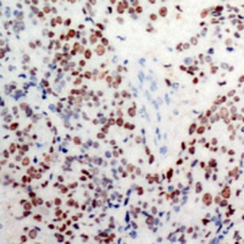 c-Jun (pS63) Antibody