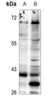 ELOVL5 Antibody