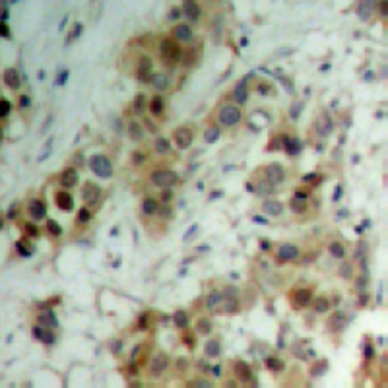 AKT (pT450) Antibody