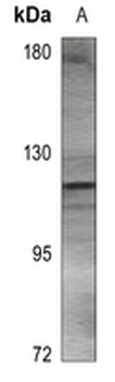 ACLY Antibody