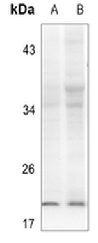 Alpha-synuclein (pY133) Antibody