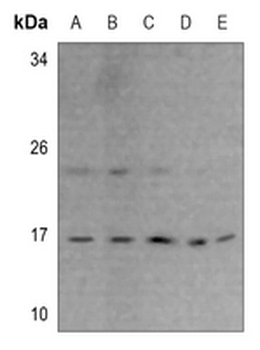RPS23 Antibody