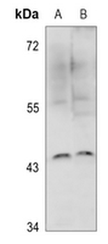 IKB epsilon Antibody